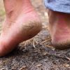 Best Home Remedies for Cracked Heels