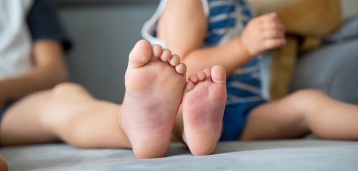 Bunions in Children and Teens: What Parents Need to Know